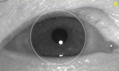 Image of eye occluded by both eyelids
