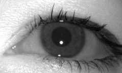 Image of eye occluded by mainly the upper eyelid