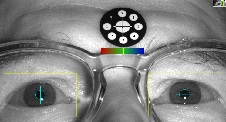 Screenshot of forehead marker placement