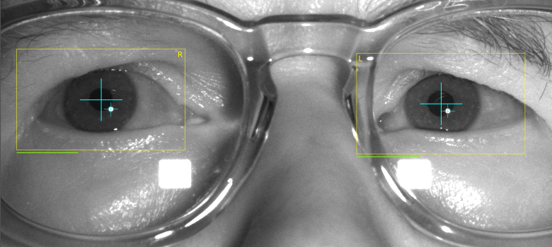 Screenshot of spectacles cleaned using dish soap as seen by eye-tracker